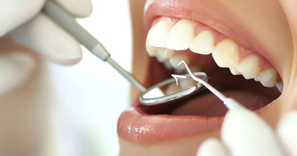 Cosmetic Dentistry - Fiocca Dental Arts - featured image