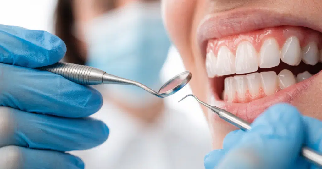 Preventive Dentistry - Fiocca Dental Arts - featured image