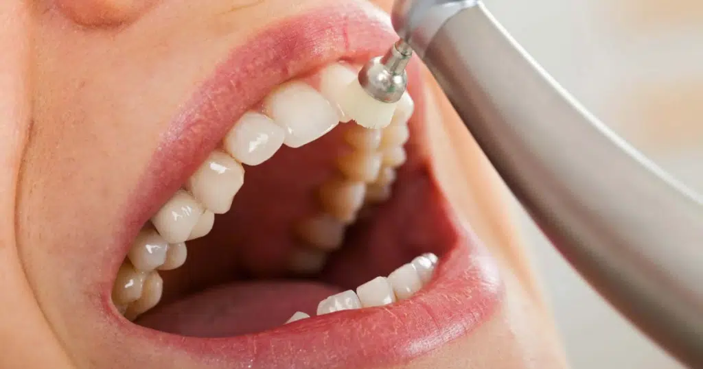 Routine Cleanings & Exams - featured image