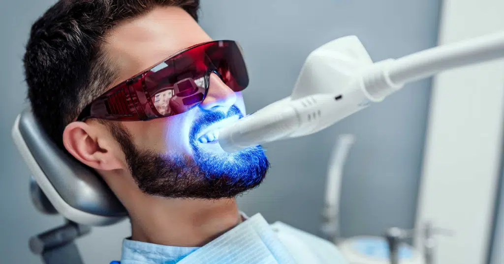 Teeth Whitening - Fiocca Dental Arts - featured image