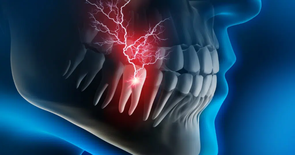 Toothaches & Pain Relief - featured image